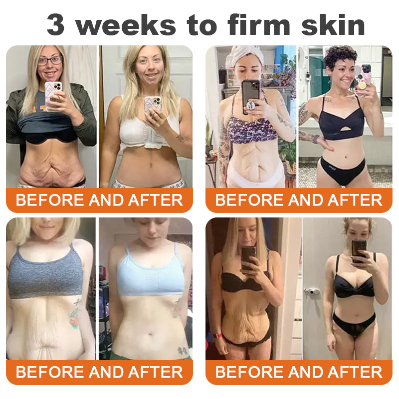 🎁Made and Shipped from USA ✨ ODALIT™ Bee venom Comprehensive Cream 🔥 LAST DAY 80% OFF 🐝💎