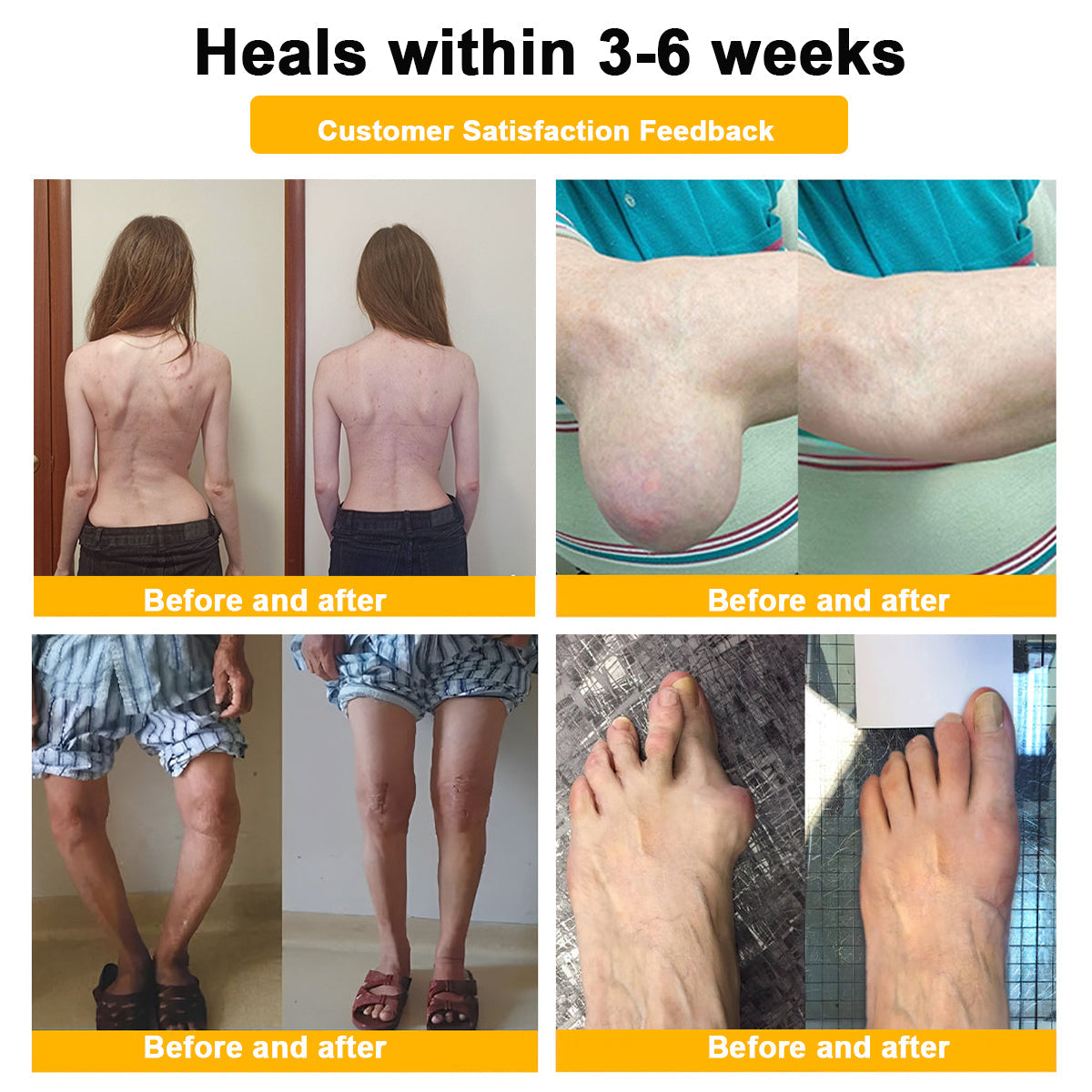 🎁Flash Sale - ODALIT™ Botulinum Toxin & Bee Venom Pain-Relief Bone Healing Cream🐝💎