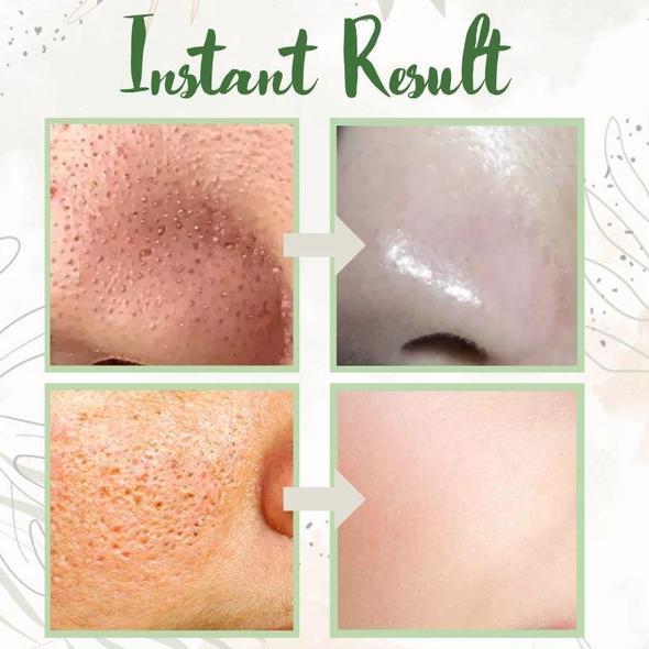 Final Sale - Green Tea Deep Cleanse Mask - (Limited time discount 🔥 last day)