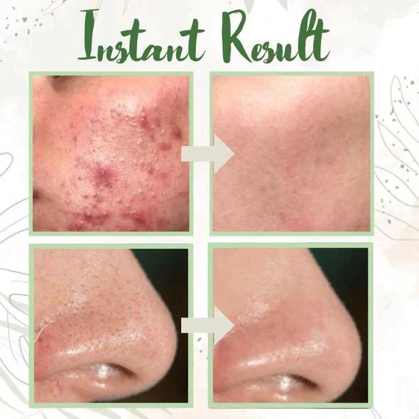 Final Sale - Green Tea Deep Cleanse Mask - (Limited time discount 🔥 last day)