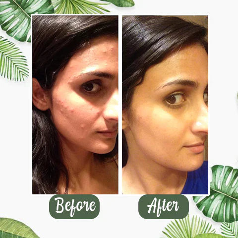 Final Sale - Green Tea Deep Cleanse Mask - (Limited time discount 🔥 last day)