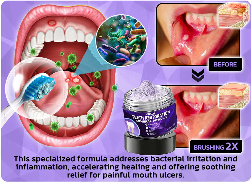 🌿Flash Sale - Don’t Miss Out - ODALIT™ Teeth Restoration Mineral Powder🦷(ADA recommended)👩⚕️(Treats periodontitis and mouth ulcers, prevents tooth loss, and repairs gum recession)