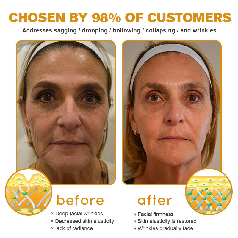 (Made and Shipped from USA) 🧑⚕️ODALIT™ Botox Bee Venom Wrinkle Removal Cream- LAST DAY 70% OFF🔥
