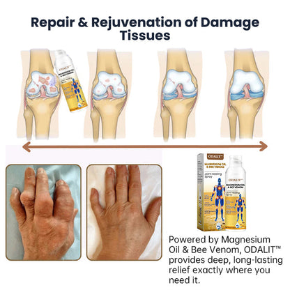 ODALIT™ Magnesium Oil & Bee Venom Joint Healing Spray🐝