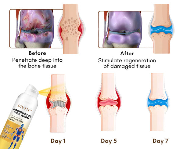 ODALIT™ Magnesium Oil & Bee Venom Joint Healing Spray🐝