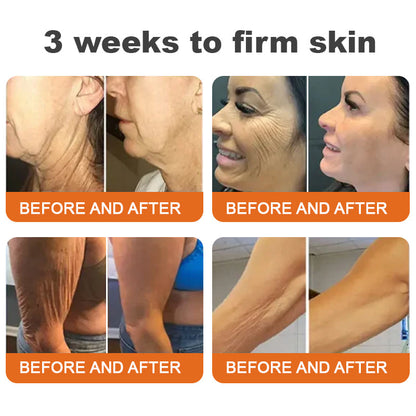 🐝💎Flash Sale - ✨ODEIUN™ BOTOX Bee Venom All-in-one Treatment Cream 🔥 LAST DAY 80% OFF 💎💎