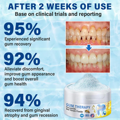 🏆ODALIT™ Focussmile Bee Venom Treatment Oral Powder 🦷(ADA Recommended)