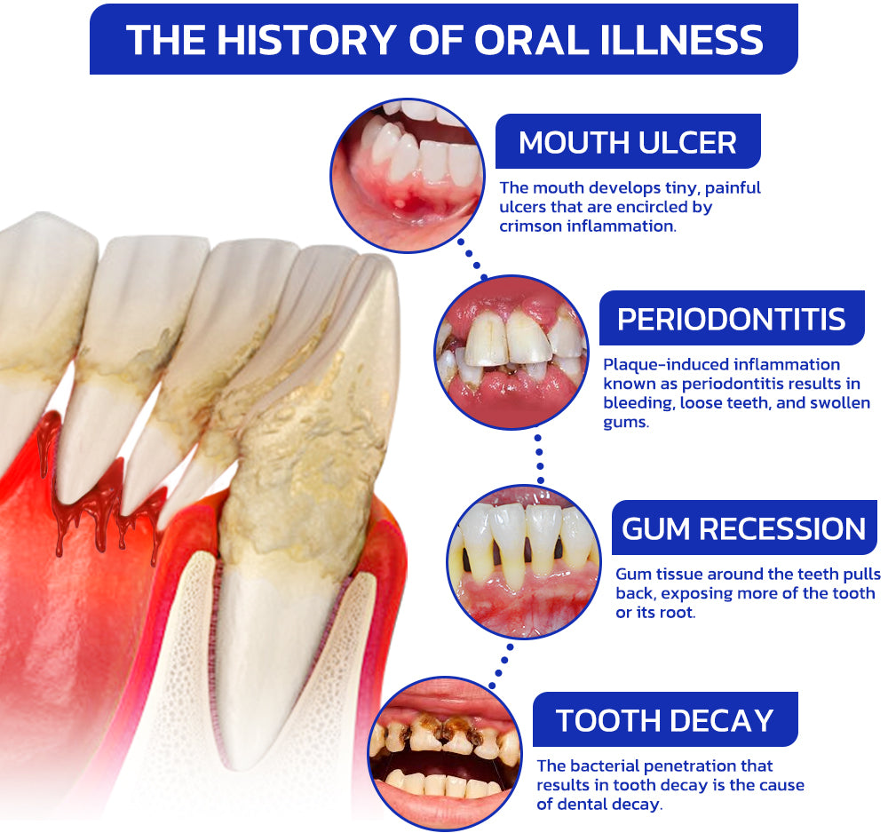 🏆ODALIT™ Focussmile Bee Venom Treatment Oral Powder 🦷(ADA Recommended)