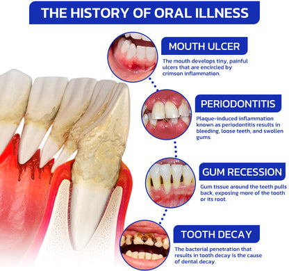 🏆ODALIT™ Focussmile Bee Venom Treatment Oral Powder 🦷(ADA Recommended)