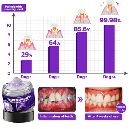 🌿Flash Sale - Don’t Miss Out - ODALIT™ Teeth Restoration Mineral Powder🦷(ADA recommended)👩‍⚕️(Treats periodontitis and mouth ulcers, prevents tooth loss, and repairs gum recession)