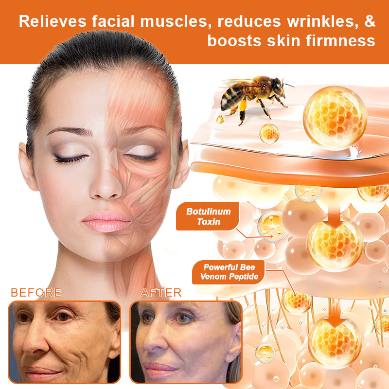 🐝💎Flash Sale - ✨ODEIUN™ BOTOX Bee Venom All-in-one Treatment Cream 🔥 LAST DAY 80% OFF 💎💎